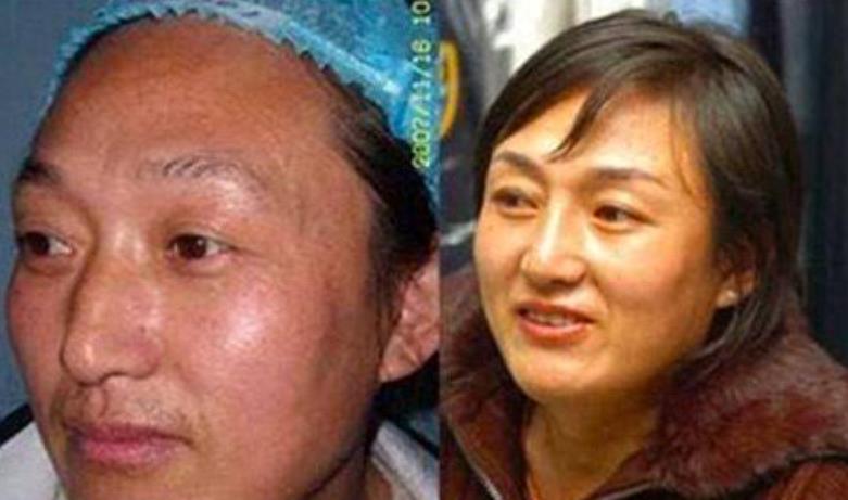 举重冠军被下什么药导致不孕的_举重运动员吃药_举重药